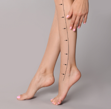 Leg Fat Reduction