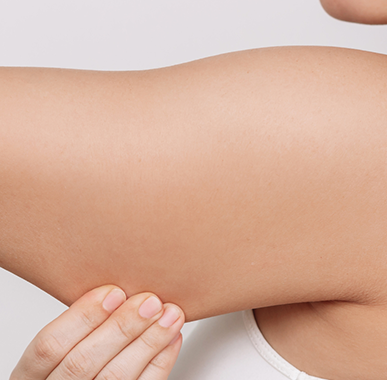 Arm Fat Reduction