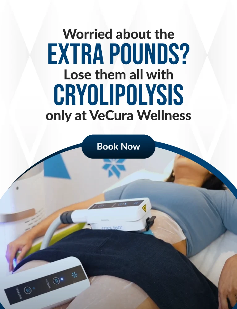 Banner showing a woman receiving Cryo360 Slim Loss treatment with text: 'Worried about the extra pounds? Lose them all with cryolipolysis, only at Vecura Wellness.'