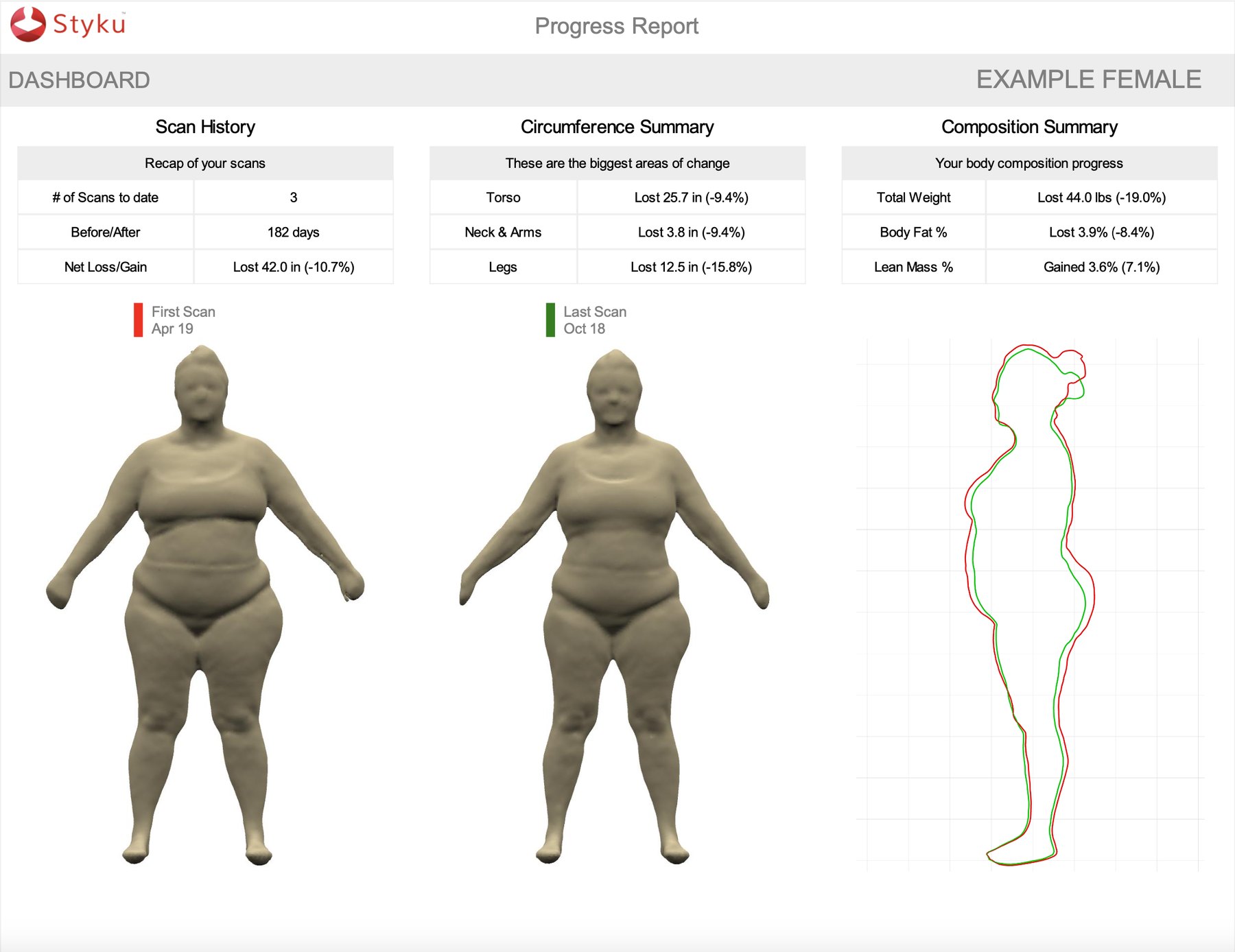 Styku progress report dashboard showing scan history, circumference summary and body composition summary