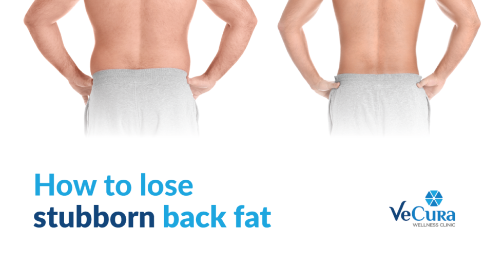 How To Lose Stubborn Back Fat? [Latest Treatments] Vecura wellness