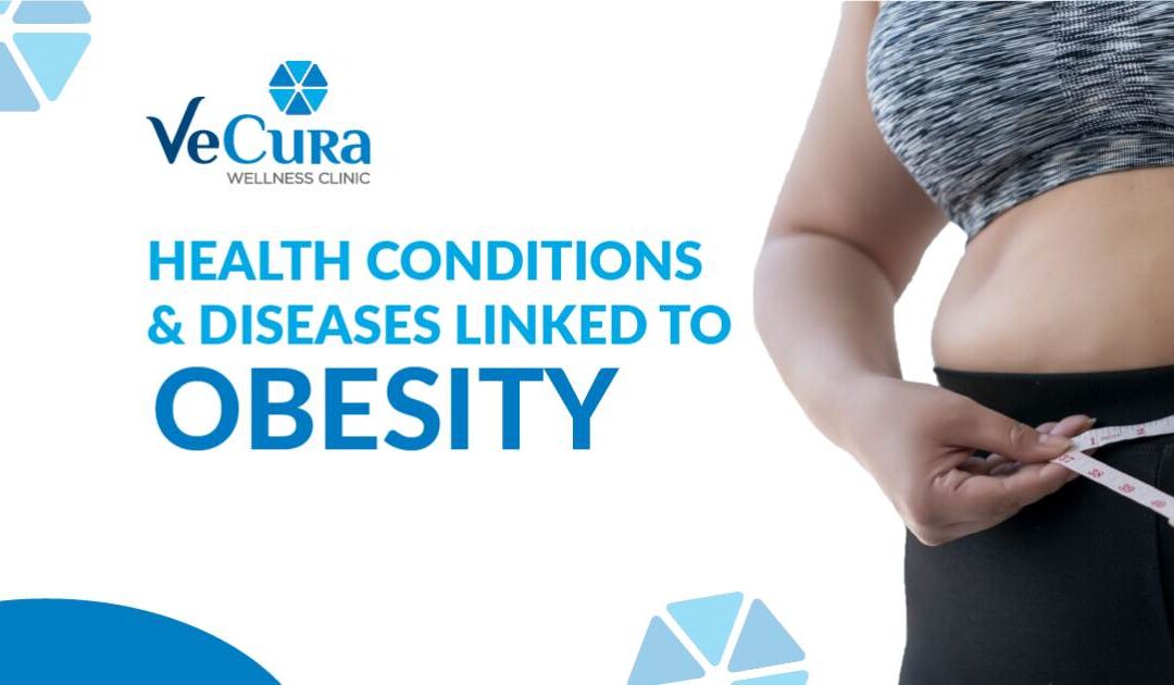 10 Health Conditions & Diseases Linked To Obesity