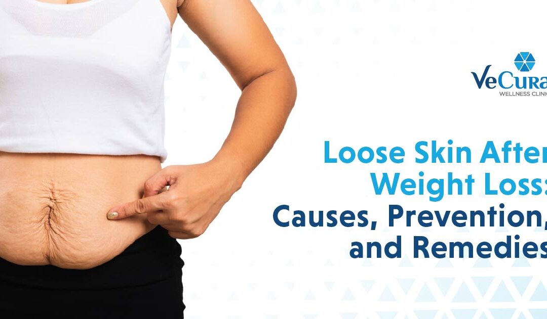 Loose Skin After Weight Loss: Causes, Prevention, and Remedies