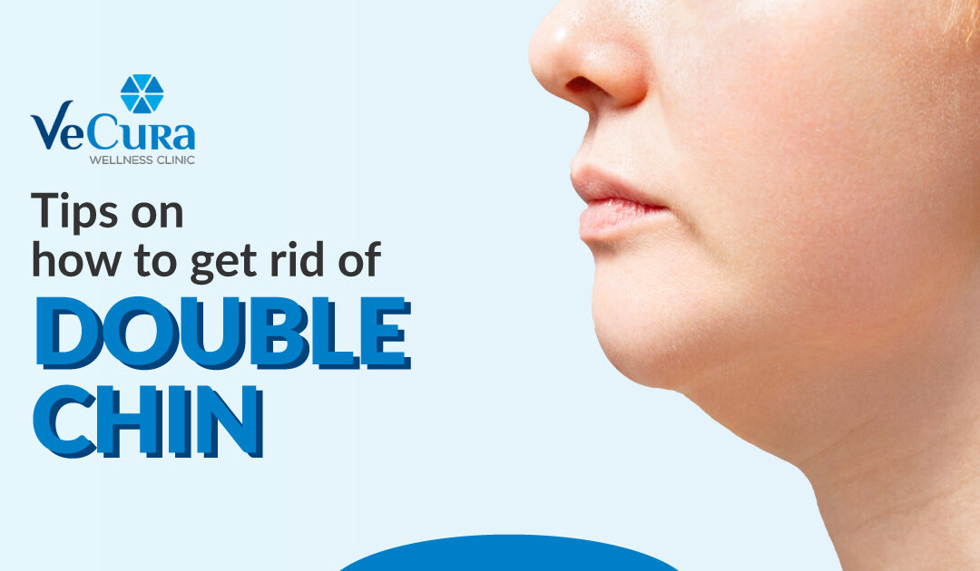 Tips On How To Get Rid Of Double Chin