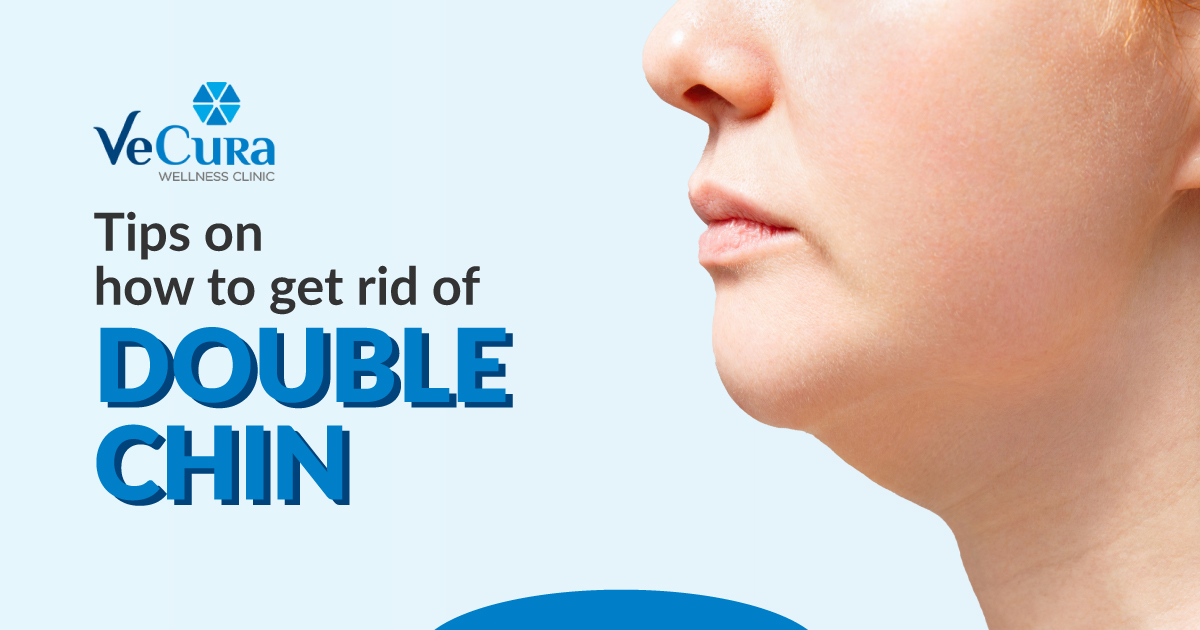 Tips On How To Get Rid Of Double Chin