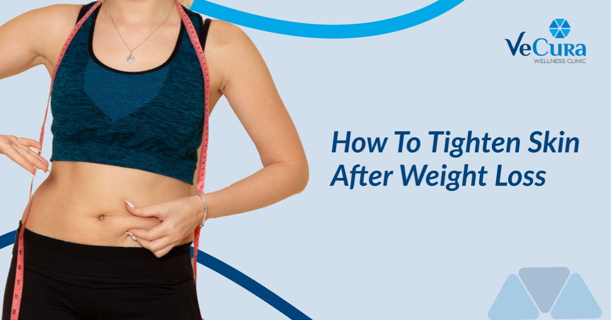 How To Tighten Skin After Weight Loss?
