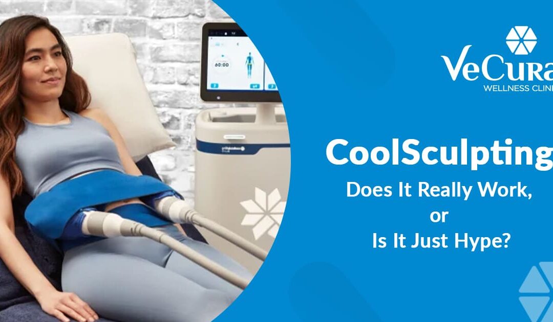 CoolSculpting – Does It Really Work, or Is It Just Hype?