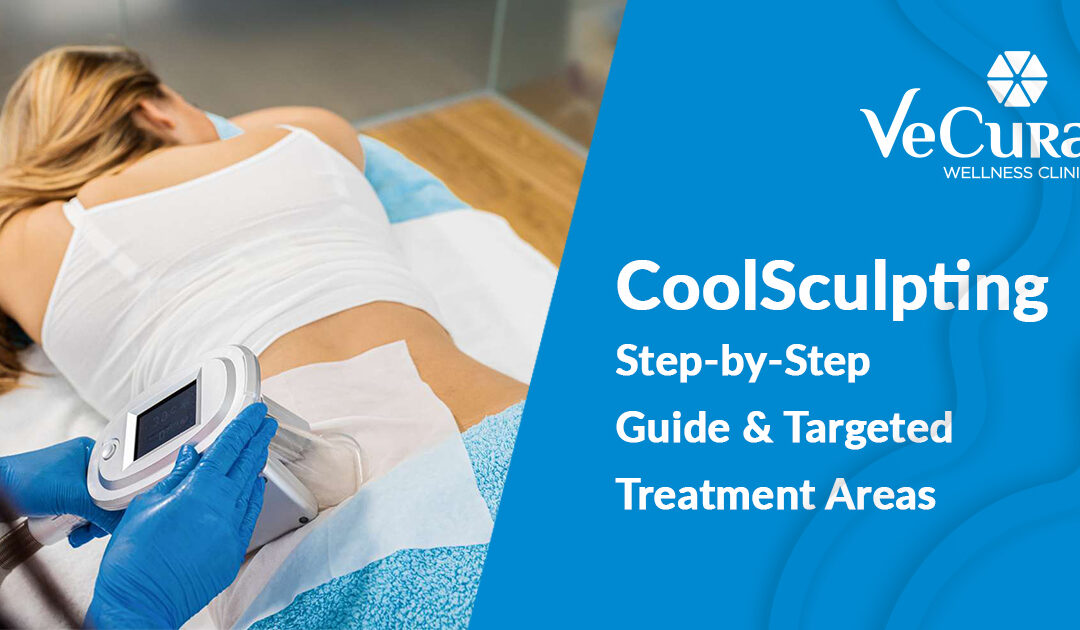 CoolSculpting Treatment – Step by Step Guide & Targeted Treatment Areas