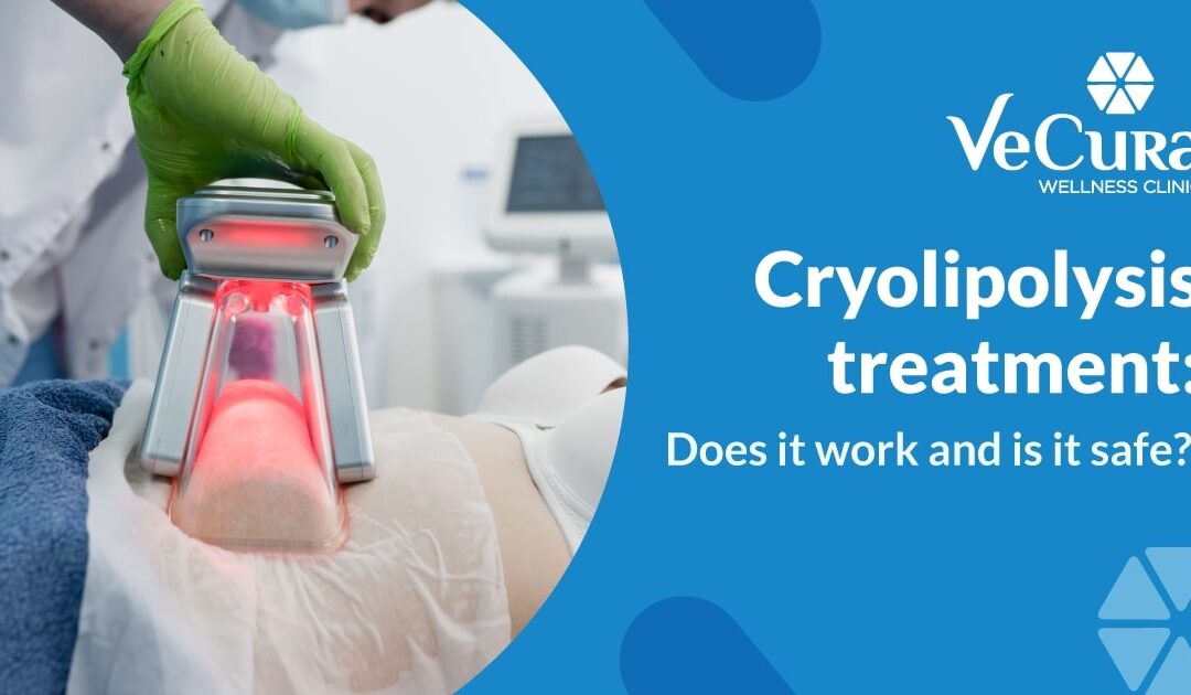 Cryolipolysis treatment: Does it work and is it safe?