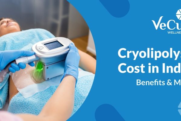 Cryolipolysis Treatment Cost in India: Benefits & More