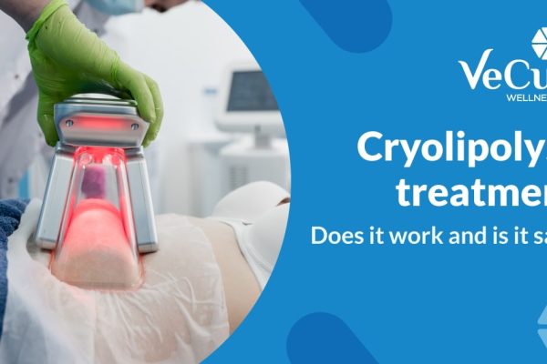 Cryolipolysis treatment: Does it work and is it safe?