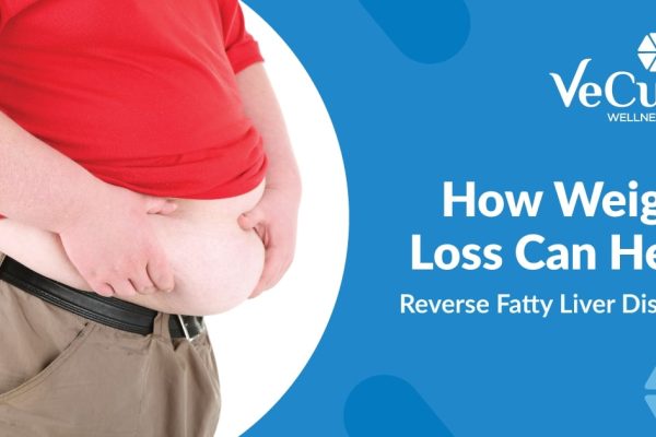 How Weight Loss Can Help Reverse Fatty Liver Disease