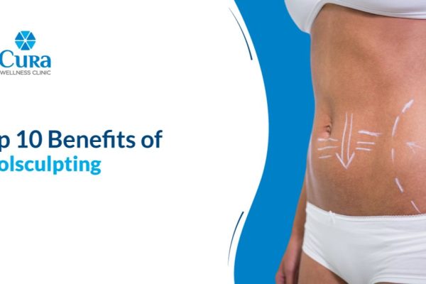 Top 10 Benefits of Coolsculpting