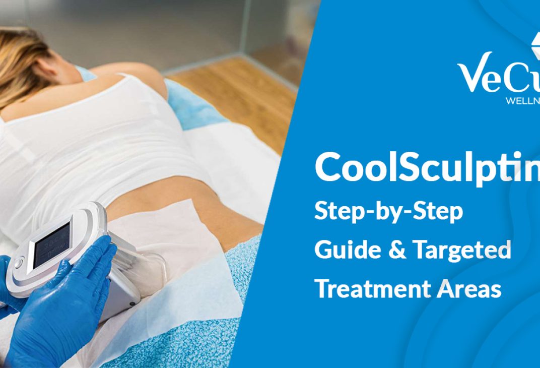 CoolSculpting step by step procedure