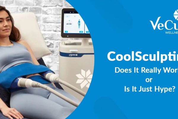 coolscuplting treatment