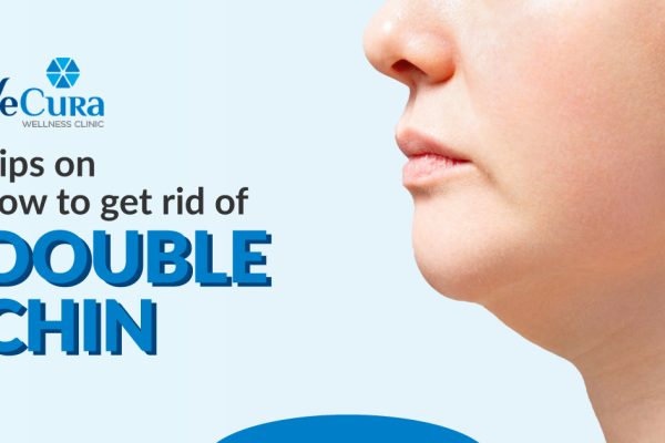Tips On How To Get Rid Of Double Chin