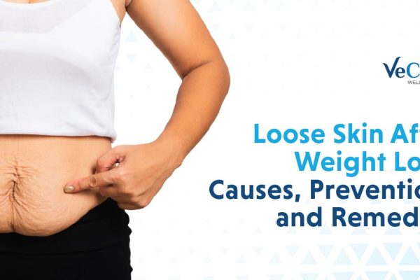 Loose Skin After Weight Loss: Causes, Prevention, and Remedies