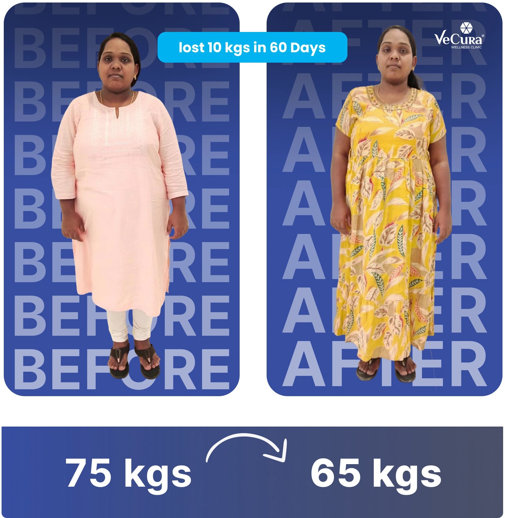 Before and after results at the best weight loss clinic in Banjara Hills showing 10 kg fat loss in 60 days at VeCura's slimming center