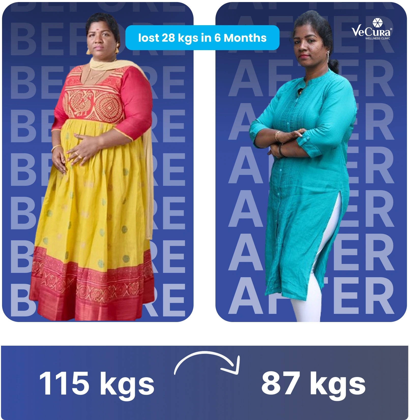Before and after results at the best weight loss clinic in Banjara Hills showing 28 kg fat loss in 6 months at VeCura's slimming center