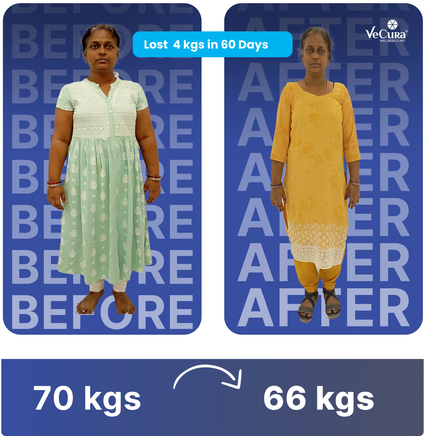 Before and after results at the best weight loss clinic in Banjara Hills showing 4 kg fat loss in 60 days at VeCura's slimming center